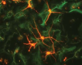 b-III Tubulin MAb (C (100 ug)