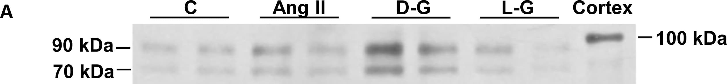 Human/Mouse/Rat/Hamster ACE-2 Antibody