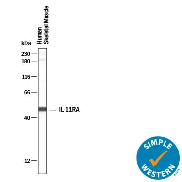 hIL-11 Ra MAb (Cl 10 (25 UG)