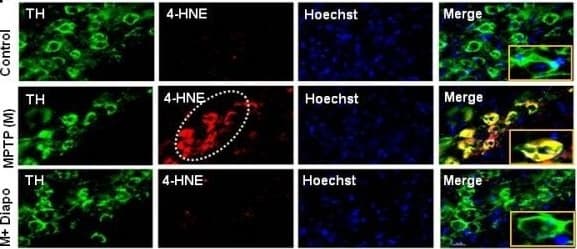 HNE MAb (Cl 198960) (25 ug)