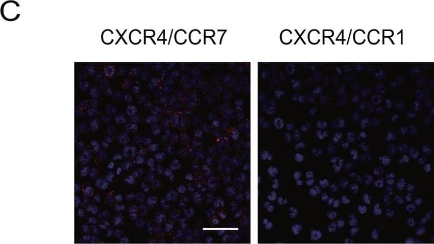 hCCR7 MAb (Cl 150503 (25 ug)