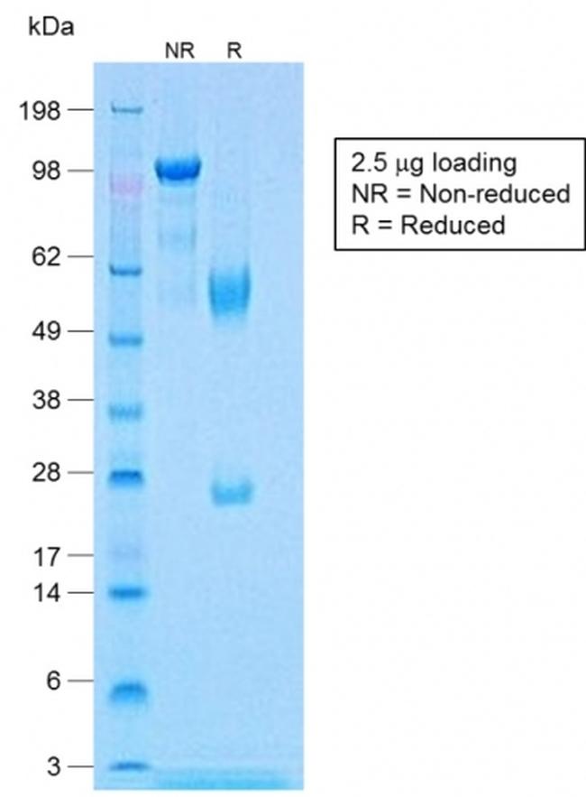CALPONIN-1