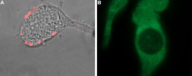 TRPM8 (EXTRACELLULAR) ANTIBODY