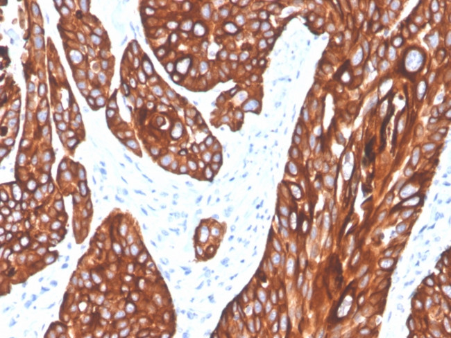 CYTOKERATIN 5 (KRT5)