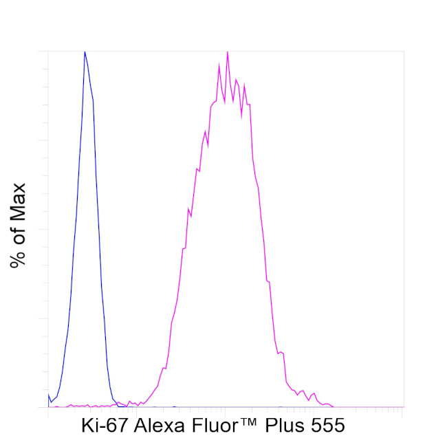 RT KI67 AFP555 RMAB