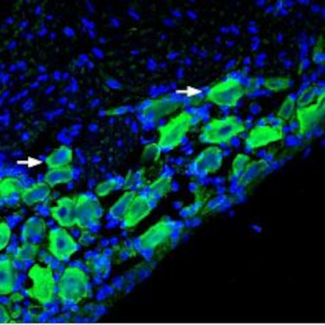 NICOTINIC ACETYLCHOLINE RECEPT