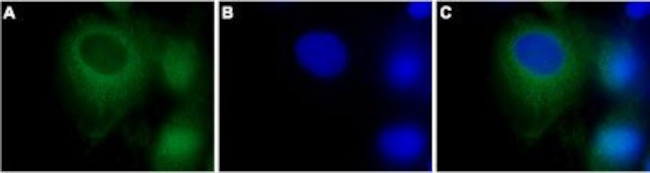 TRPC3 ANTIBODY