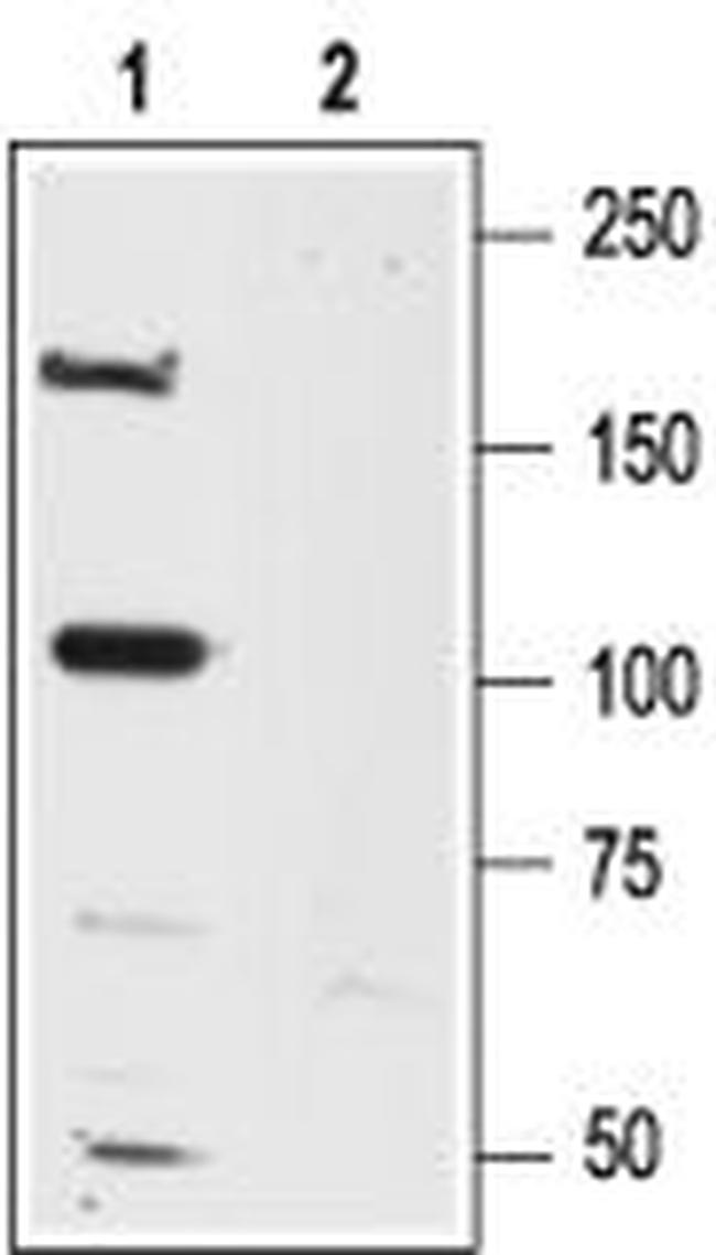 NMDAR2A (GLUN2A) (EXTRACELLULA