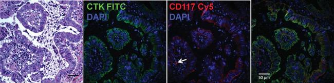 ANTI-PAN CYTOKERATIN EF570 MAB