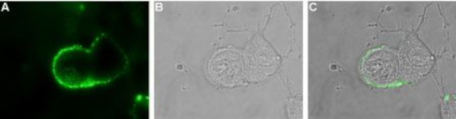 PAN ASIC (EXTRACELLULAR) ANTIB