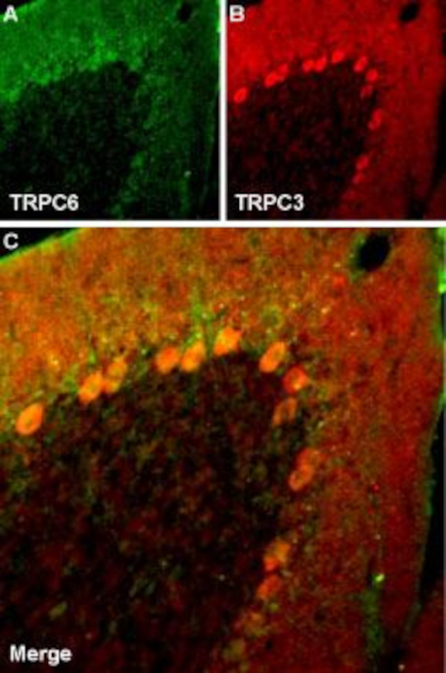 TRPC3 ANTIBODY