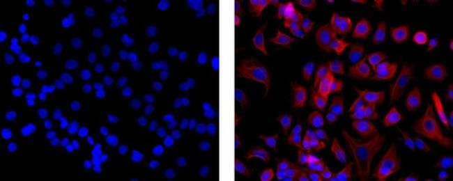 ANTI-PAN CYTOKERATIN EF660 MAB
