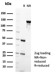 NUCLEOLIN (MARKER OF HUMAN CEL