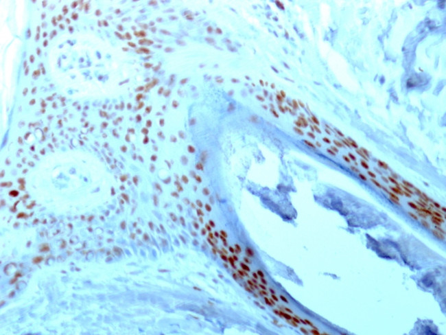 NUCLEOLIN (MARKER OF HUMAN CEL