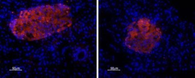 P2X7 RECEPTOR ANTIBODY