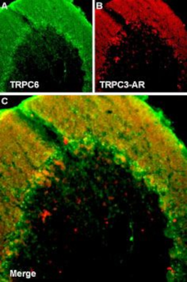 TRPC3 ANTIBODY ATTO 594