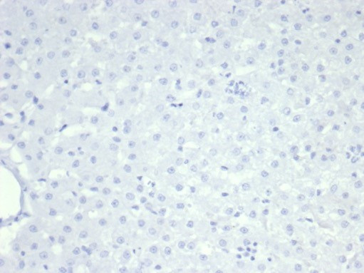 NUCLEOLIN (MARKER OF HUMAN CEL