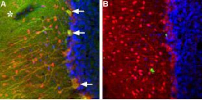 TRPC3 ANTIBODY