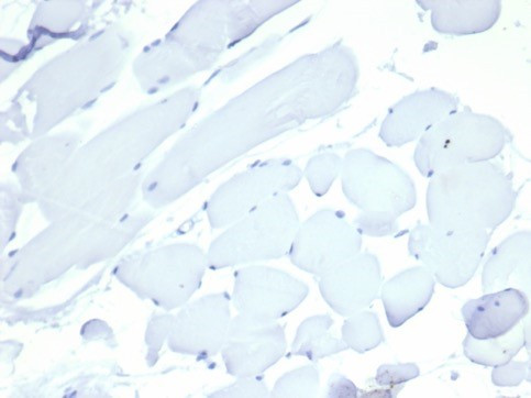 NUCLEOLIN (MARKER OF HUMAN CEL