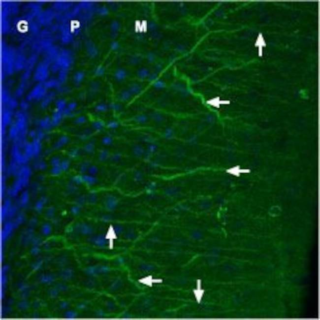 CAV1.2 (CACNA1C) ANTIBODY ATTO