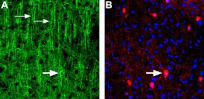 NICOTINIC ACETYLCHOLINE RECEPT