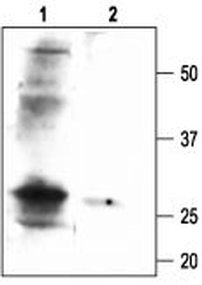 SLO BETA 1 (KCNMB1) ANTIBODY