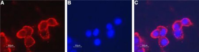 NICOTINIC ACETYLCHOLINE RECEPT