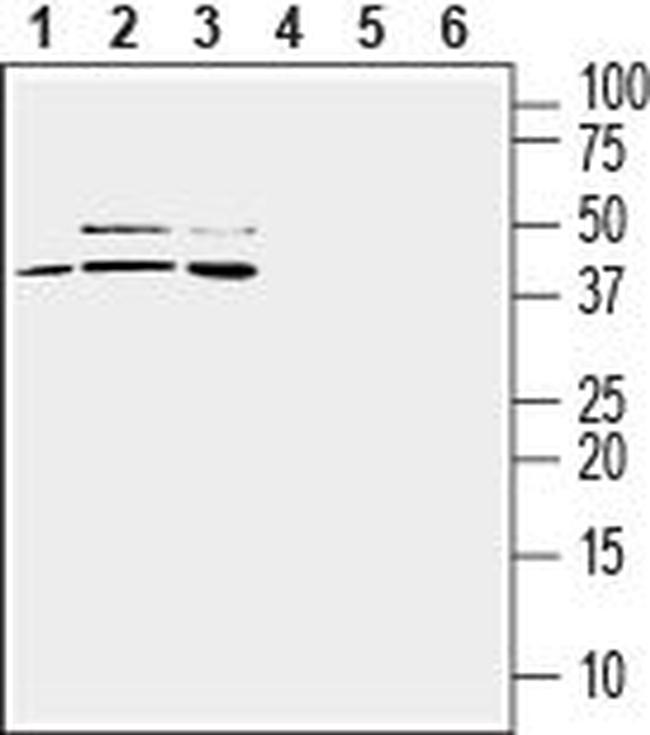 TREM2 (EXTRACELLULAR) ANTIBODY