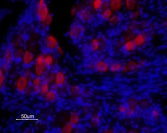 TRPV1 (VR1) (EXTRACELLULAR) AN