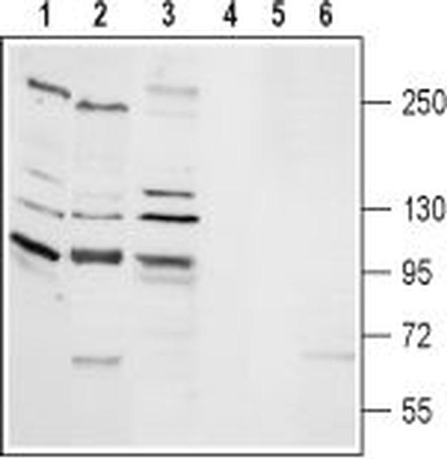 TRPM2 ANTIBODY