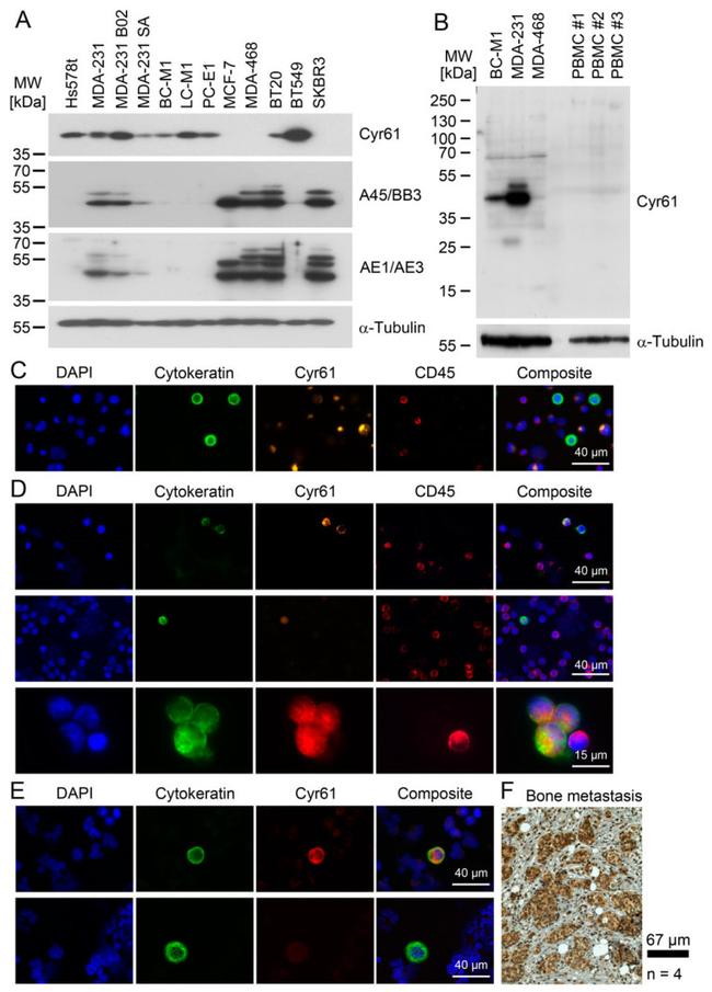 ANTI-PAN CYTOKERATIN EF570 MAB