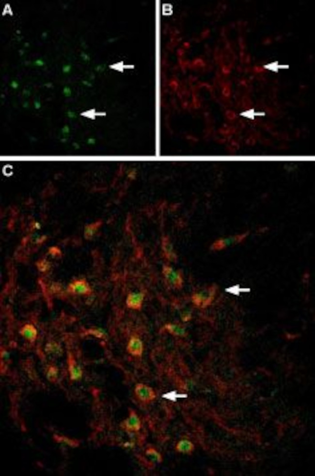 TRPC3 ANTIBODY ATTO 594