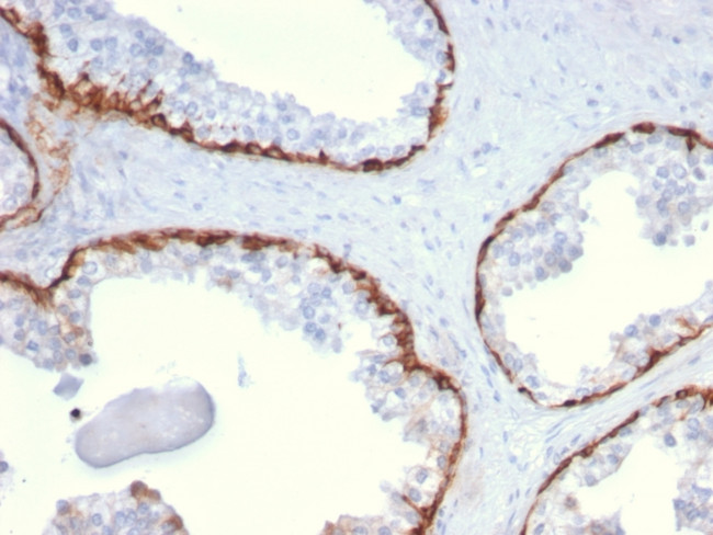 CYTOKERATIN 15 (ESOPHAGEAL SQU