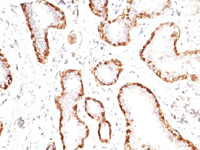CALPONIN-1 (SMOOTH MUSCLE MARK