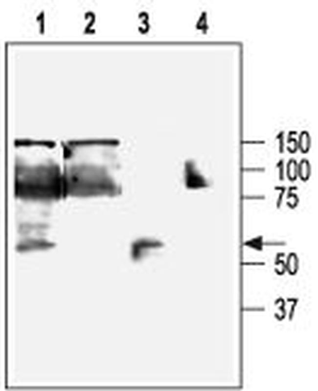 KCNN4 (KCA3.1- SK4) ANTIBODY