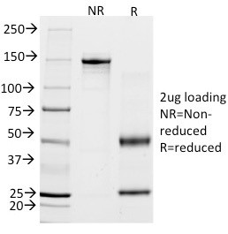 CALPONIN-1 (SMOOTH MUSCLE MARK