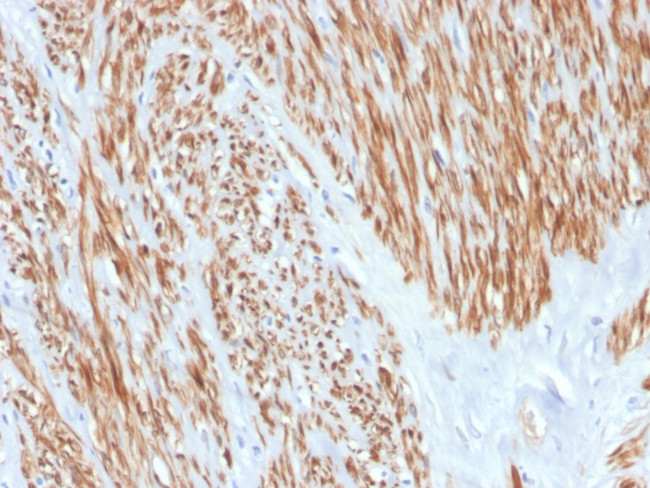 CALPONIN-1