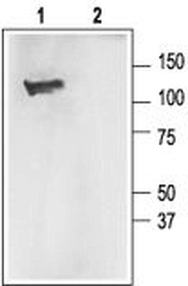KCNMA1 (KCA1.1) (1097-1196) AN