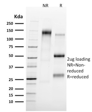 TAL1 ANTIBODY