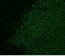 NUCLEOLIN (MARKER OF HUMAN CEL