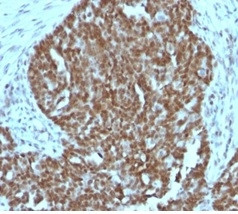 NUCLEOLIN (MARKER OF HUMAN CEL