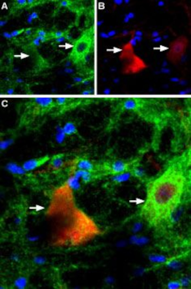 P2X4 RECEPTOR ANTIBODY