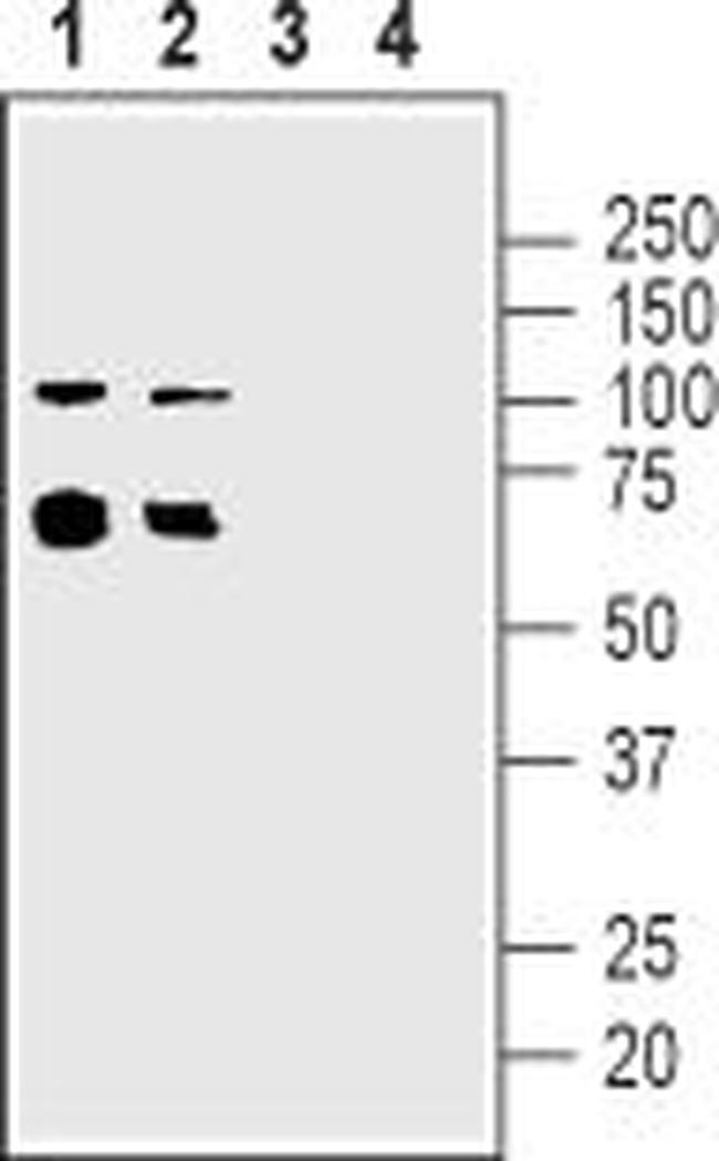 NICOTINIC ACETYLCHOLINE RECEPT