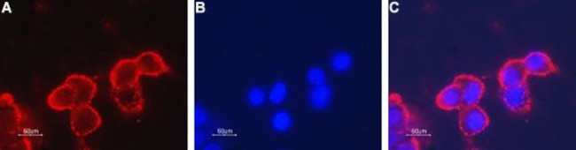 NICOTINIC ACETYLCHOLINE RECEPT