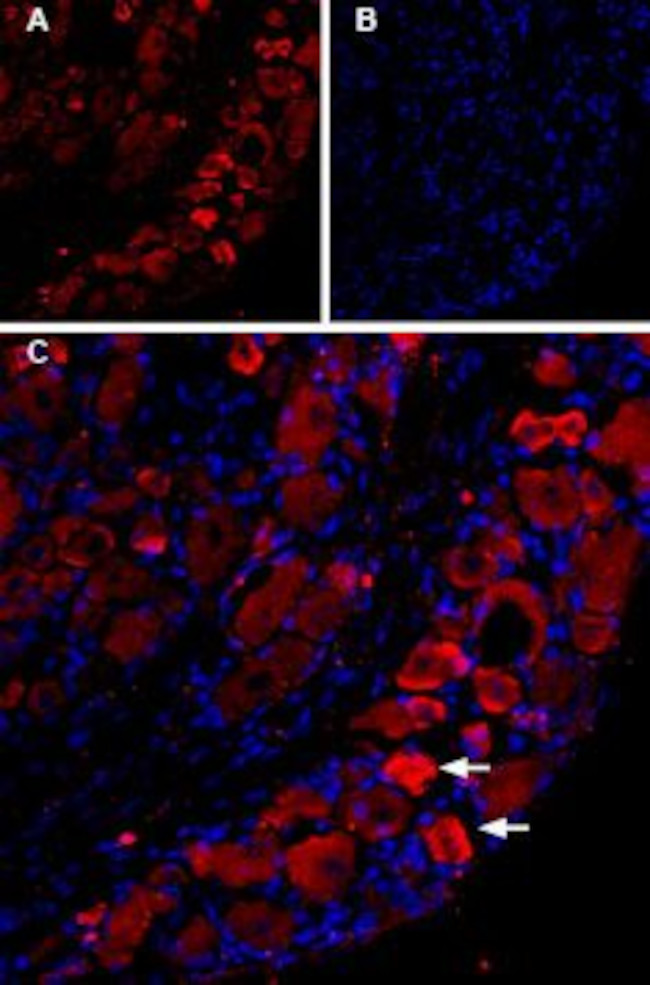 TRPV1 (VR1) ANTIBODY