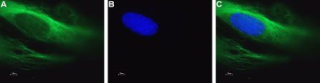 CAV1.2 (CACNA1C) ANTIBODY ATTO