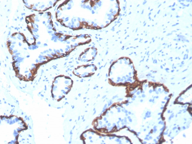 CYTOKERATIN 5 (KRT5)