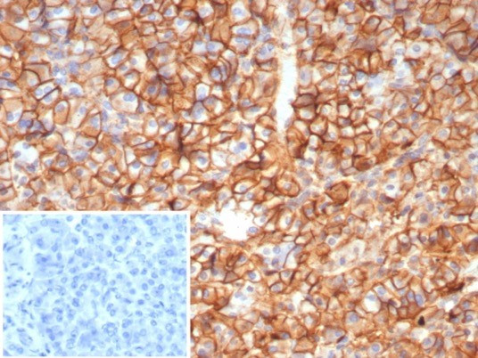 CD99/MIC2 (EWING‘S SARCOMA MAR