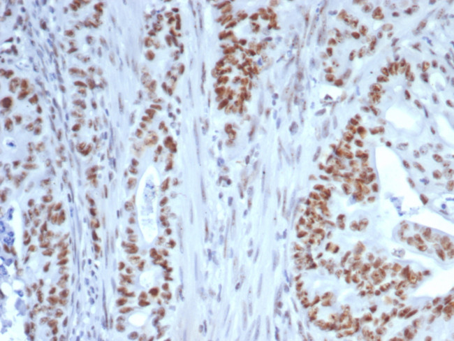 NUCLEOLIN (MARKER OF HUMAN CEL