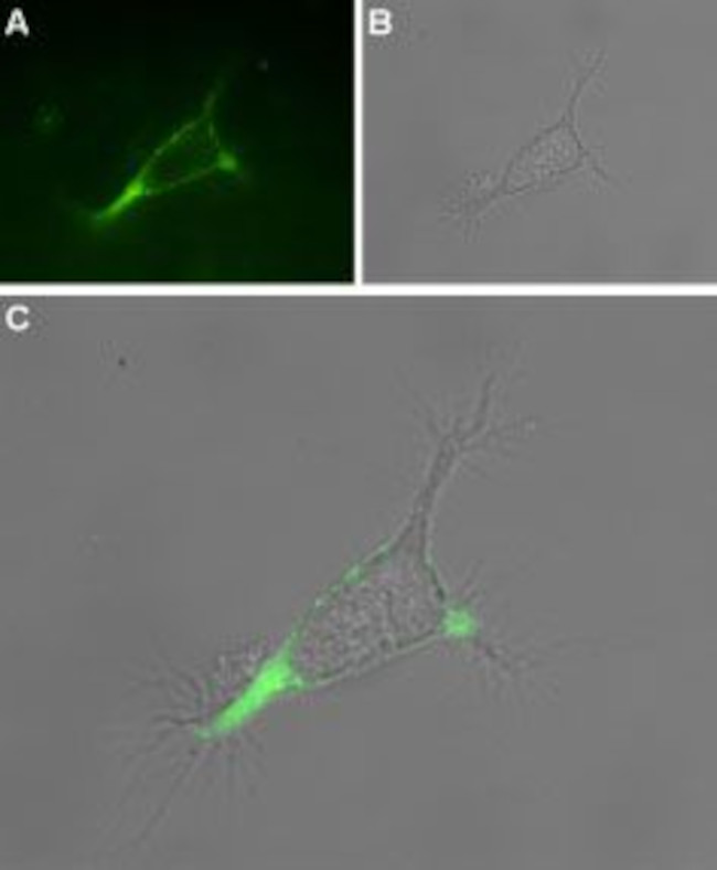 TRPV1 (VR1) (EXTRACELLULAR) AN